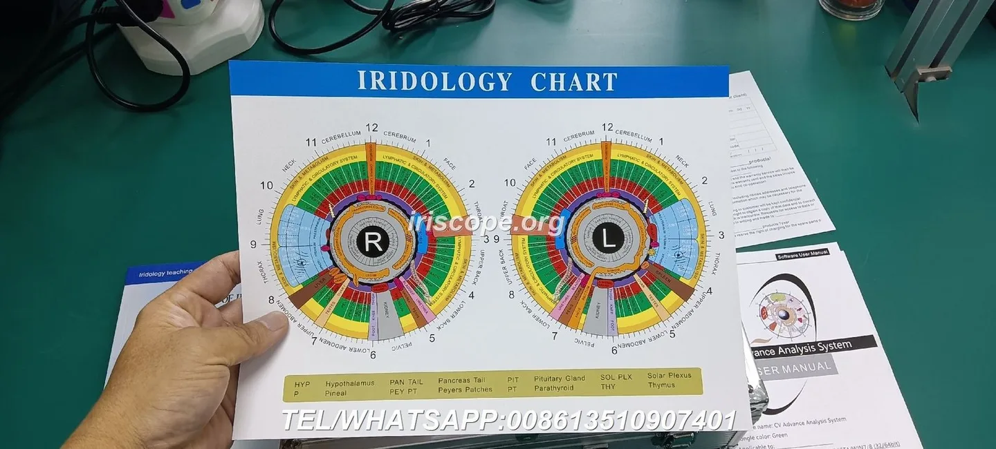 MAIKONG 5MP Iridology camera MK 980U MK 980U — maikong iridology camera 9822 for window and apple mac os (63).JPG