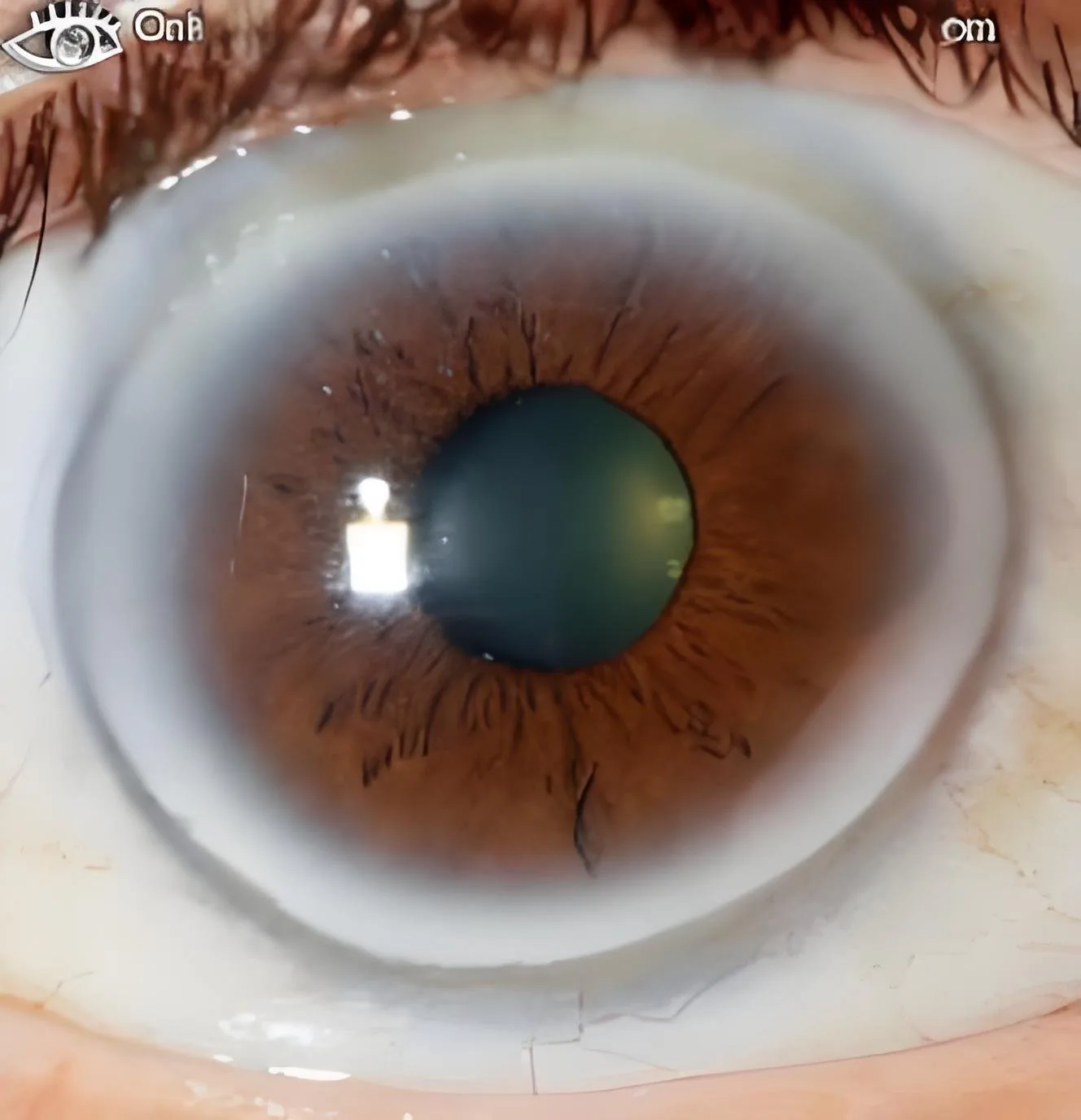 Clinic workflow for multi‑practitioner iridology: a practical, clinic‑ready SOP for UK practices — Iridología (3).jpg