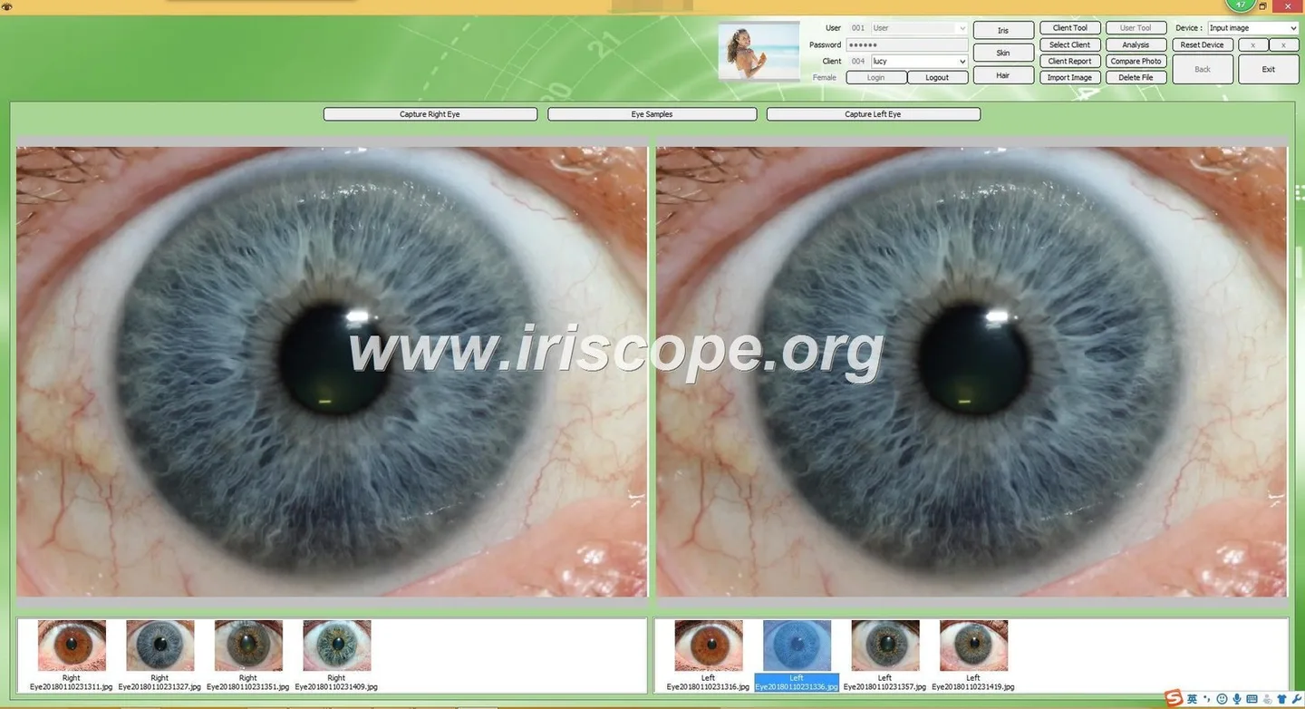 Portable iriscope setup for mobile wellness visits in the UK — Software de Iridología (30).JPG