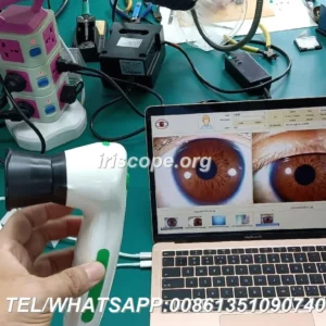 What should buyers compare before purchasing an iriscope? A practical guide for UK health assessment providers — maikong iridology camera iriscope 12 mp for apple mac os (36).JPG