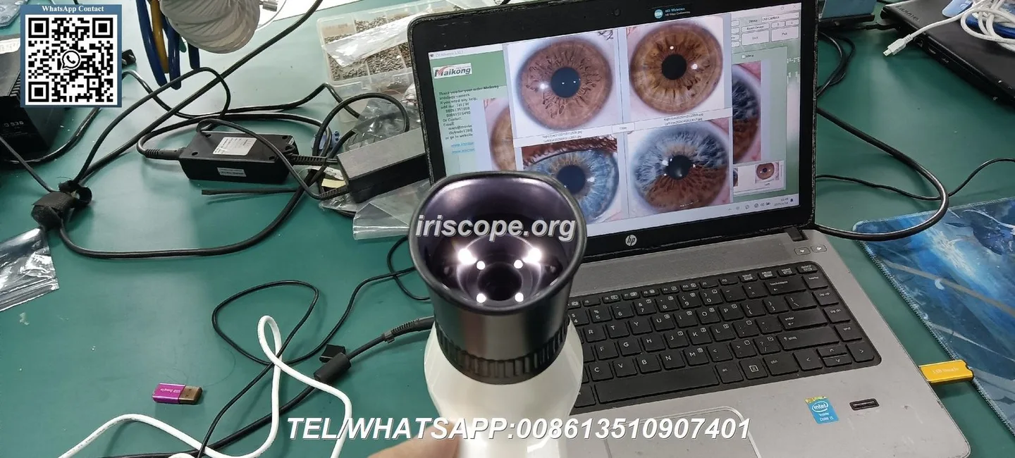 What buyers and practitioners should know when searching for an iridology cam in the UK — 085.JPG