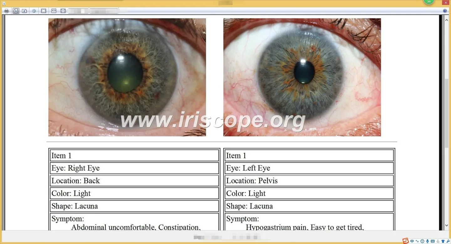 What buyers and practitioners should know when searching for an iridology cam in the UK — Software de Iridología (53).JPG