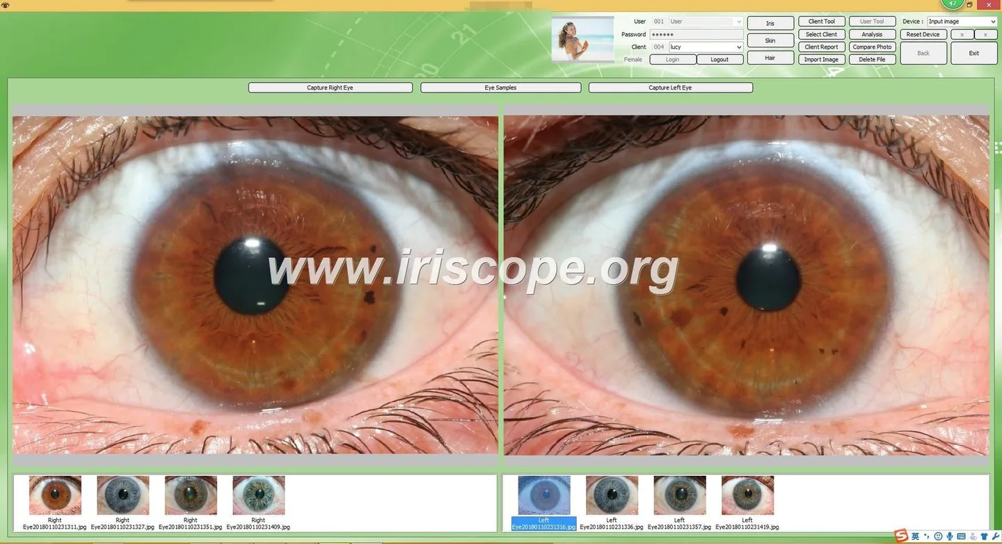 What buyers and practitioners should know when searching for an iridology cam in the UK — Software de Iridología (29).JPG