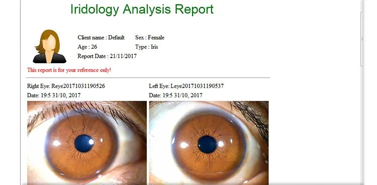 What reflexologists should know when searching for an iriscope in the UK — appareil photo iridologie (20).jpg