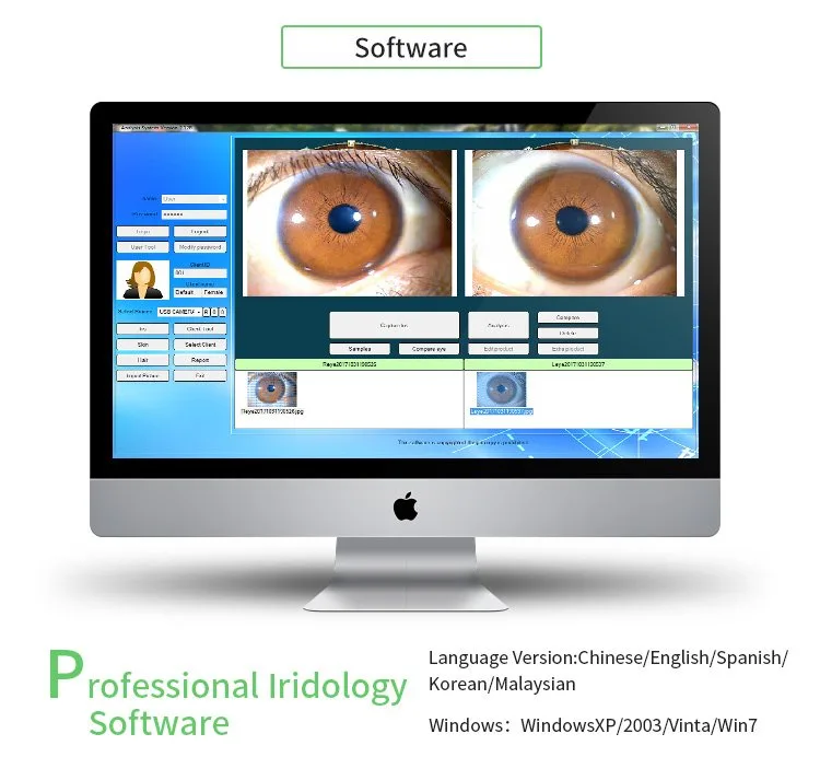 What reflexologists should know when searching for an iriscope in the UK — appareil photo iridologie (18).jpg