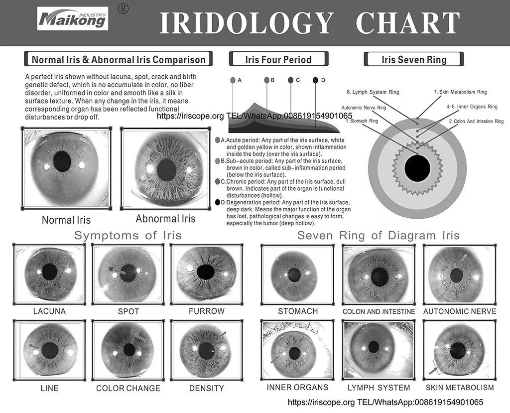 What reflexologists should know when searching for an iriscope in the UK — MAIKONG iridologia mapa (3).jpg